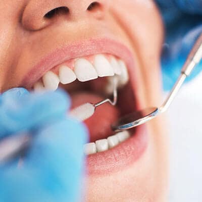 The mouth of a woman who is being checked by the dentist using preventative dentistry instruments